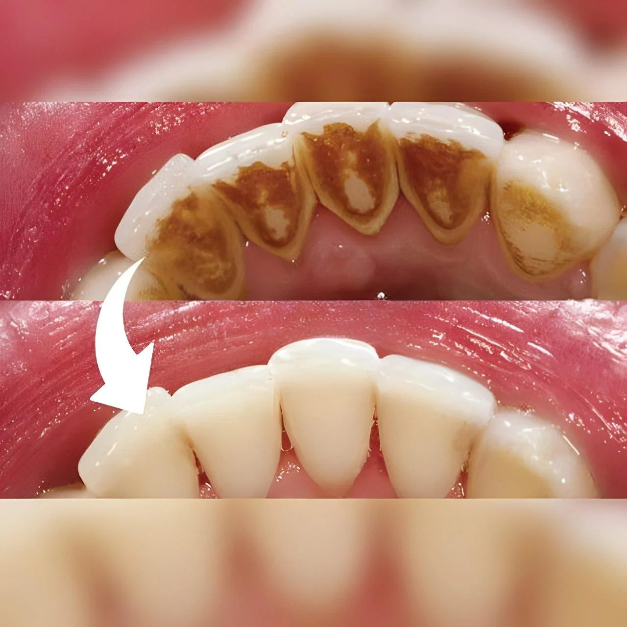 professional-dental-scaler-41191001_4.jpg